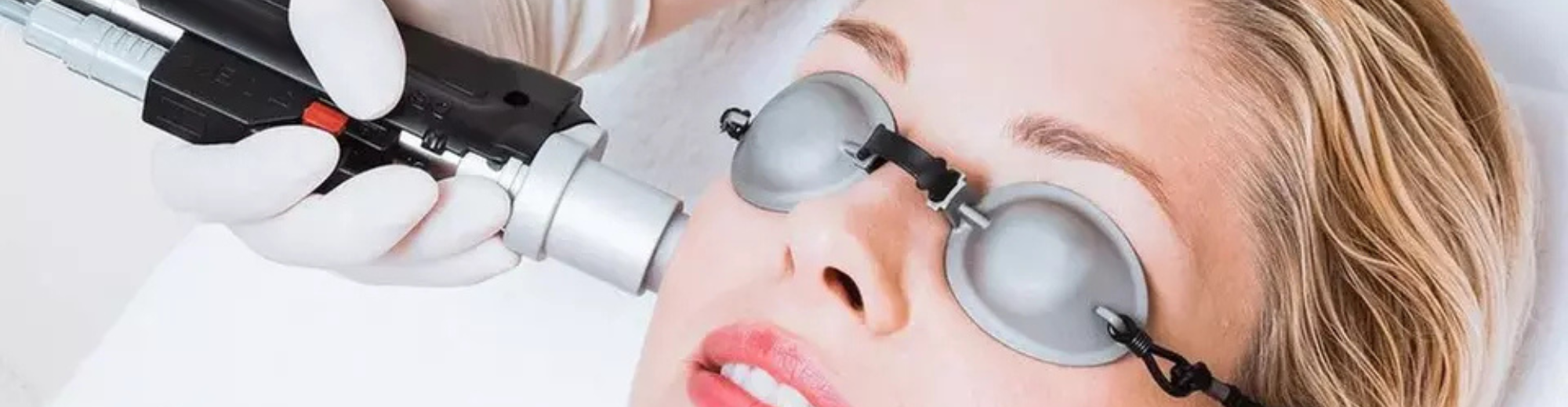 ლაზერული ეპილაცია 